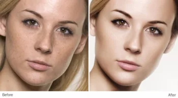 Retouching