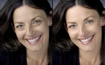It's not just celebrities that are retouched -- it's your friends on Facebook, too!